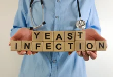 Yeast Infection